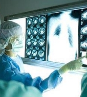 Маркетинговое исследование российского рынка рентгенодиагностической техники для визуализации 